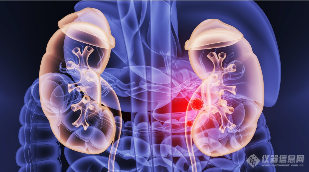 Pg电子平台：地表水中可溶性阳离子知多少？离子色谱IC-16显身手(图2)